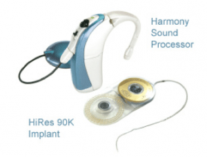AdvancedBionics-Harmony Cochlear Implant