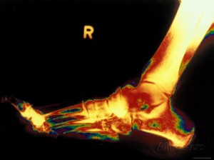 x-ray of right foot poster image from allposters.com