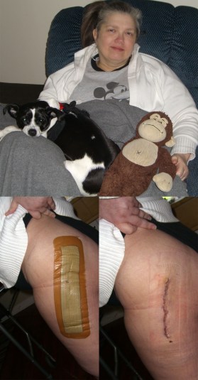 Wendy Hip Replacement Recovery - April 2015 photos by w holcombe